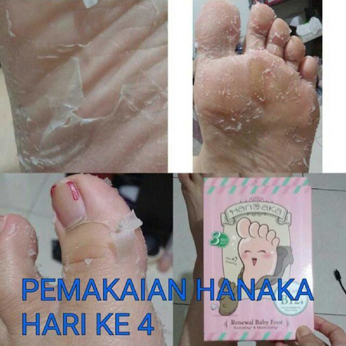 SALE!! READY STOCK HANAKA BABY FOOT KULIT KAKI TUMIT PECAH-PECAH PERAWATAN KAKI