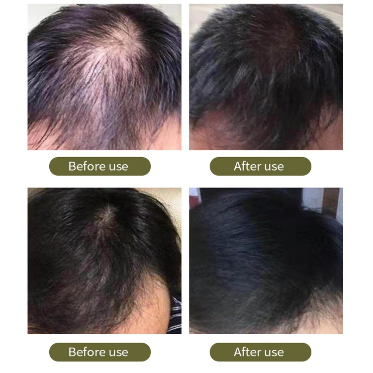 Shampo jahe Shampo rambut 200ml Cegah Rambut Rontok Anti-ketombe pertumbuhan rambut cepat Oil Controlled Nutrition