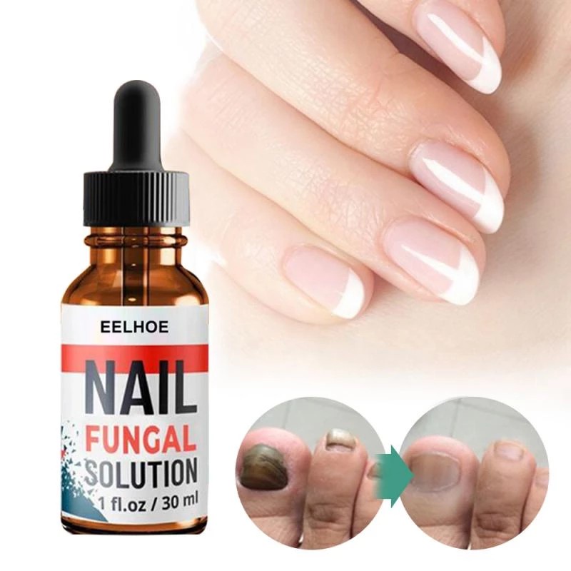 Sumifun Nail Repair Perawatan Krim Jamur Kuku Nail Treatment Nail Fungus Obat Kuku Jamur Perawatan Kuku Rusak Repair -30ml