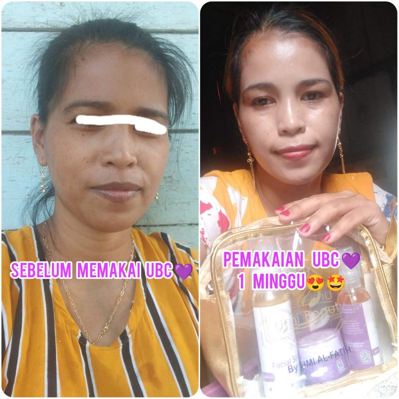 UBC SKINCARE PAKET KOMPLIT UMI BEAUTY CARE