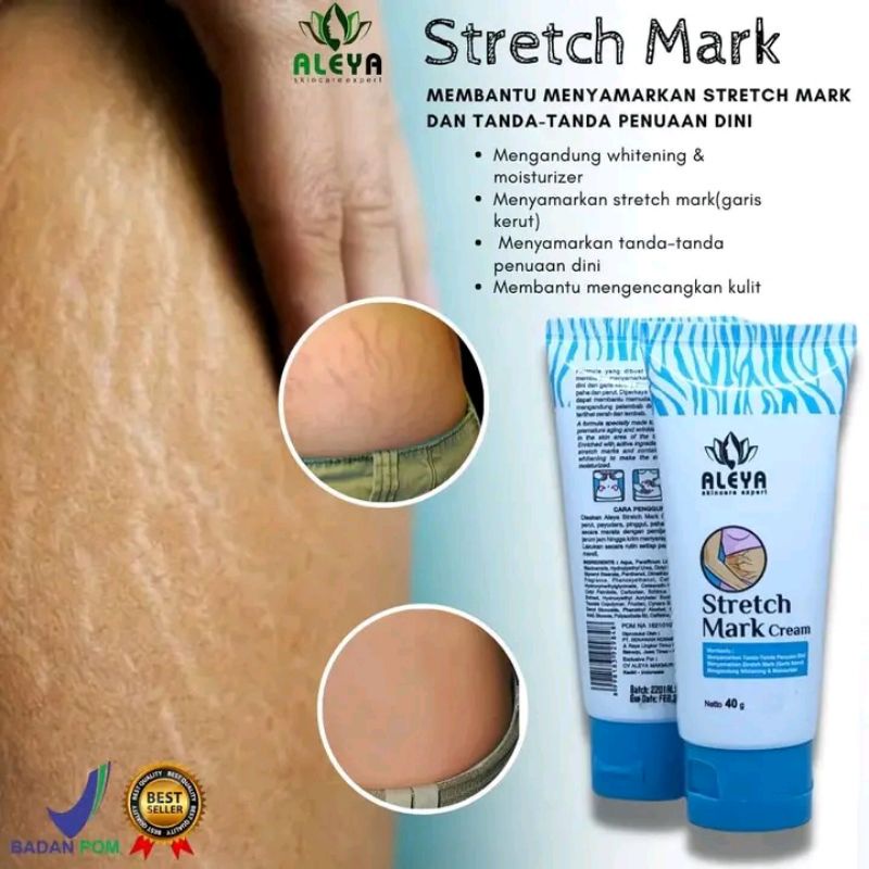 Cream Stretcmark Aleya Pudarkan Stretch mark Dan Selulit