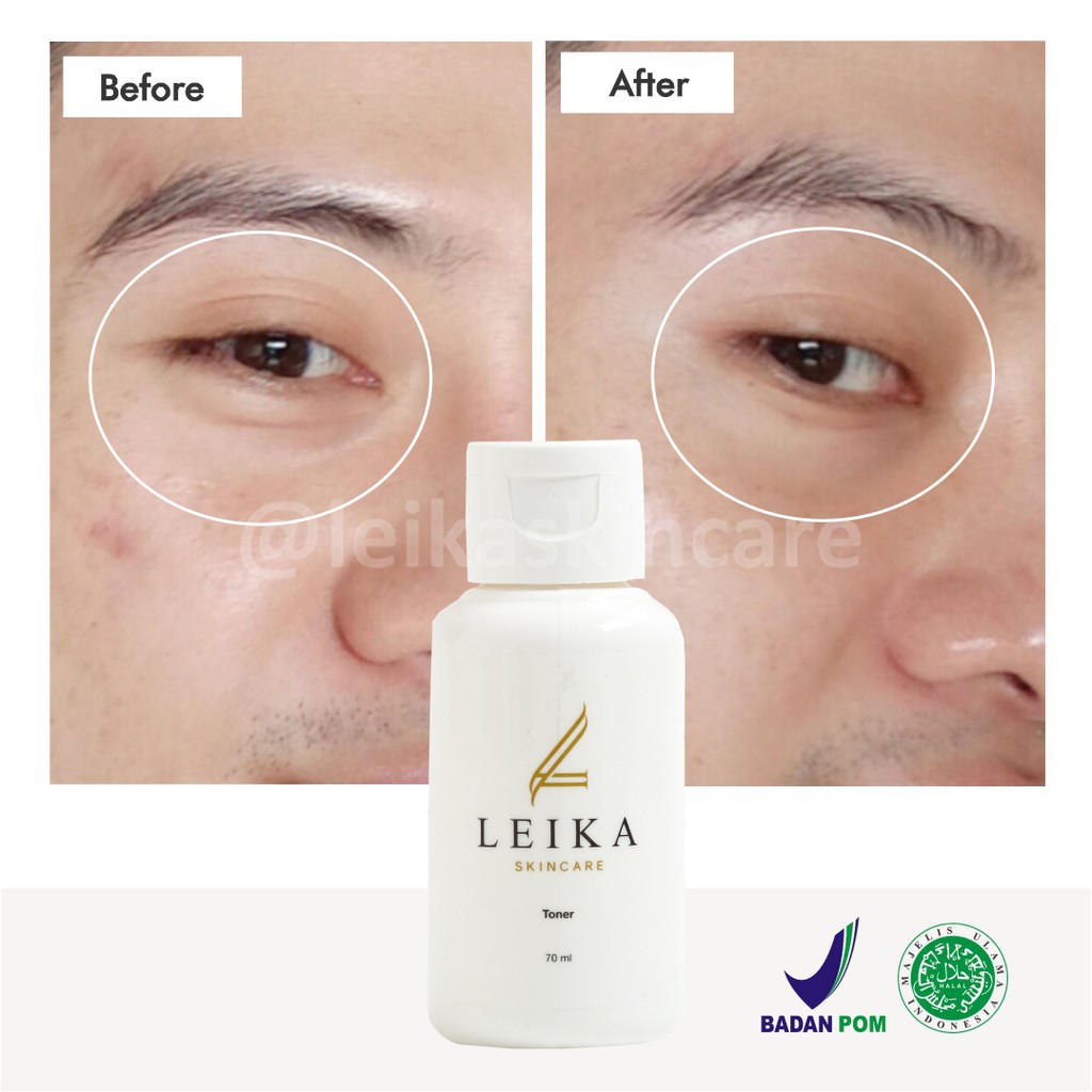 AMPUH Leika Skincare Toner Mata Panda - Penghilang Kantung Mata Hitam Pria dan Wanita Permanen BPOM