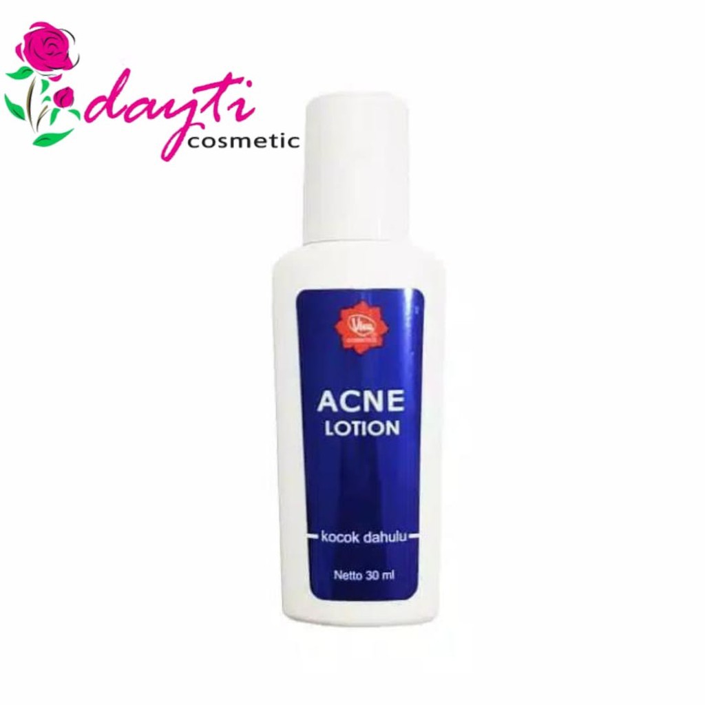 Jual Viva acne lotion 30ml Shopee Indonesia