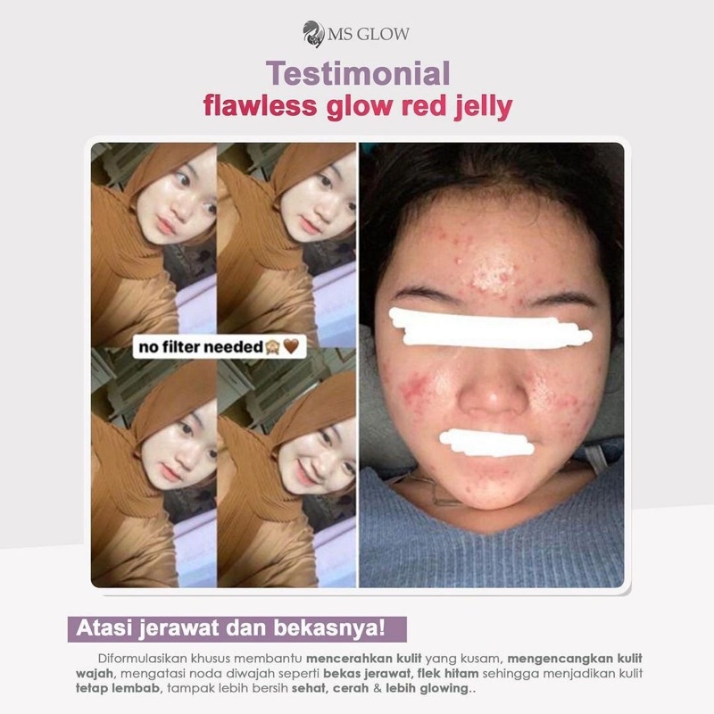 (BISA COD |Buy 1 Get gift) [RESSELER RESMI] MS GLOW FLAWLESS GLOW RED JELLY