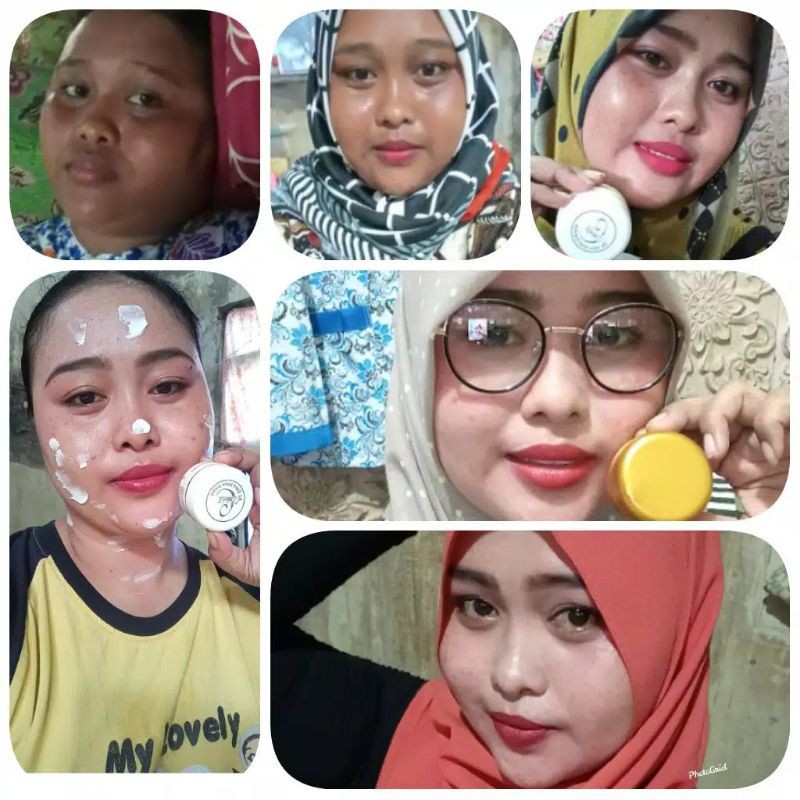 BEB WHITE C SKINCARE ORIGINAL 100% Glowing Series - Acne Series