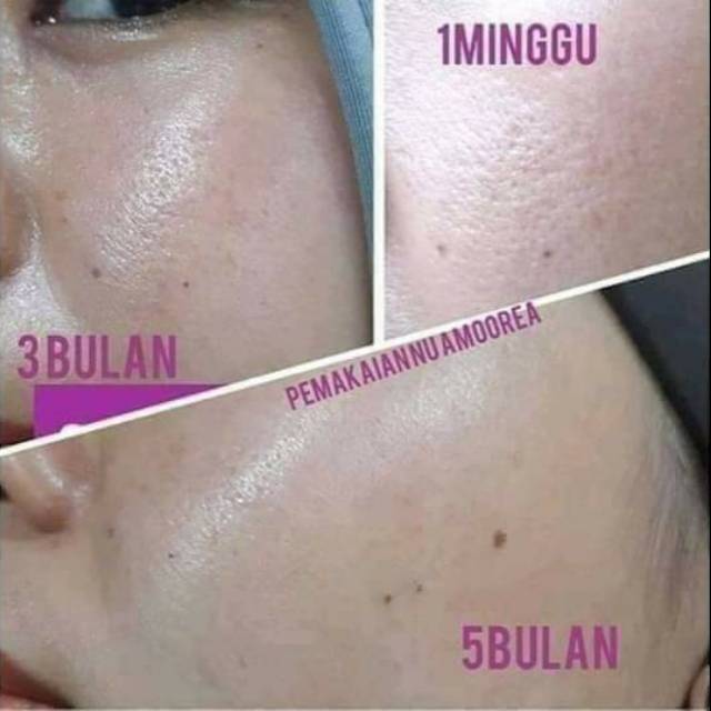Nu Amoorea beauty plus original 100%
