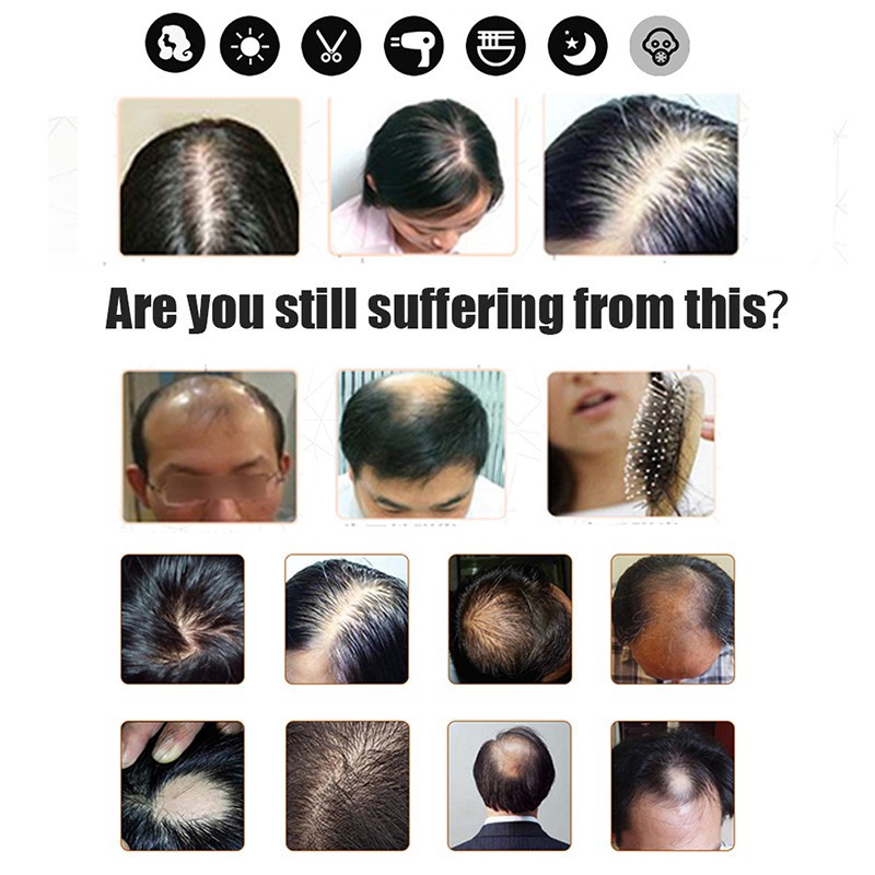 (BISA COD) (DALAM 7 HARI!!) Cairan Essence Penumbuh Rambut Minyak Penumbuh Rambut Obat Pria Wanita Botak Lebat Tebal Rontok Tipis Minyak Kemiri-3