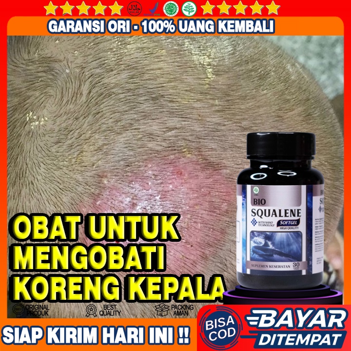 Obat Koreng Kepala - Obat Koreng Bernanah - Obat Untuk Luka Koreng Berair Dan Gatal - Obat Luka Kore