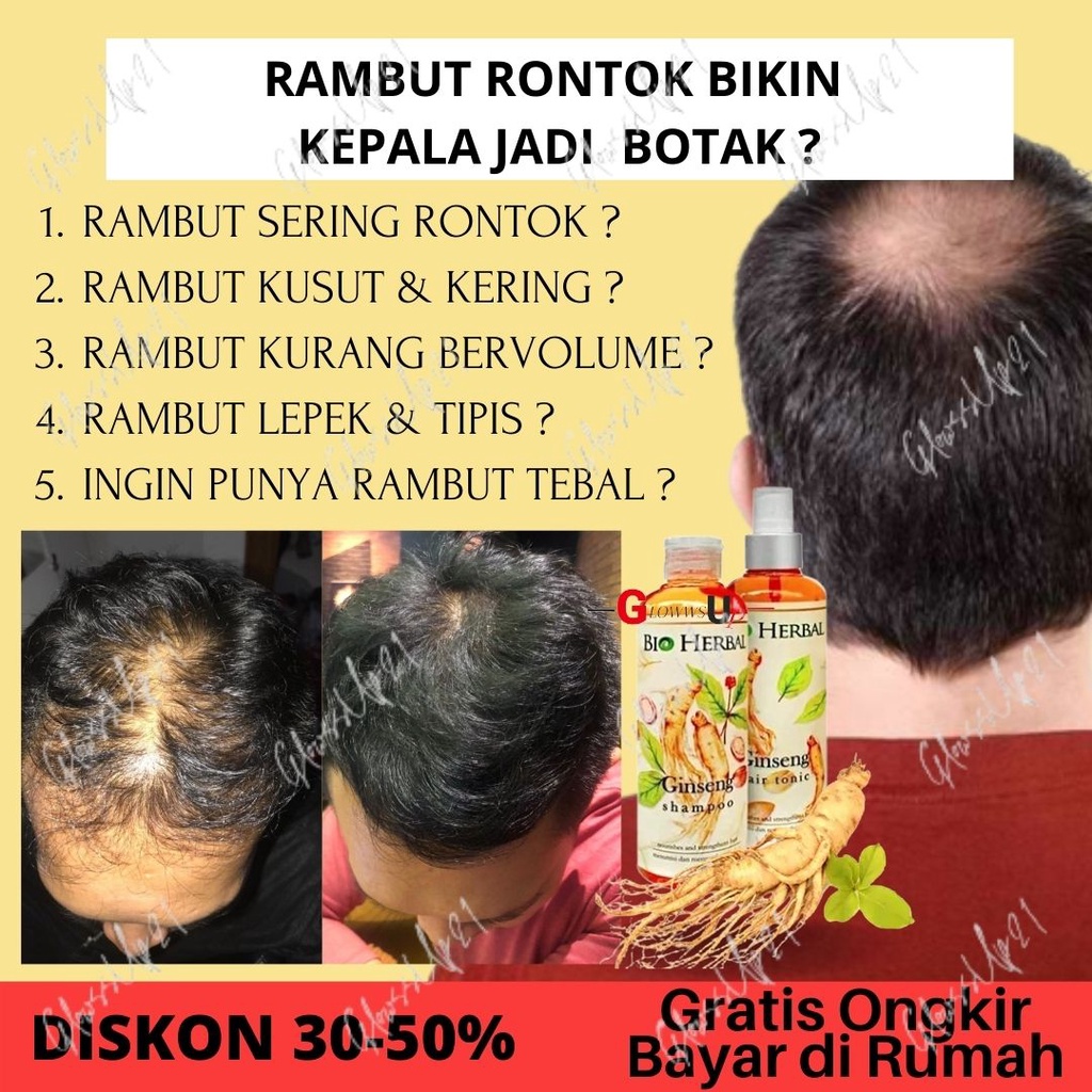 PENUMBUH RAMBUT KEBOTAKAN - SHAMPO PENUMBUH RAMBUT - BIO HERBAL GINSENG PAKET SHAMPO &amp; HAIR TONIC ORIGINAL