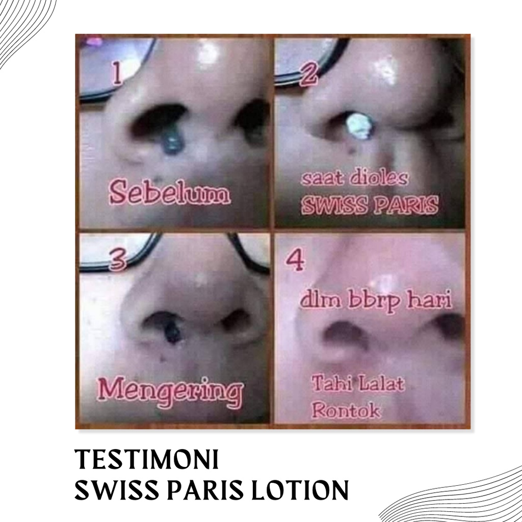 SWISS PARIS LOTION PENGHILANG KUTIL DAN TAHI LALAT ASLI HILANG PERMANEN