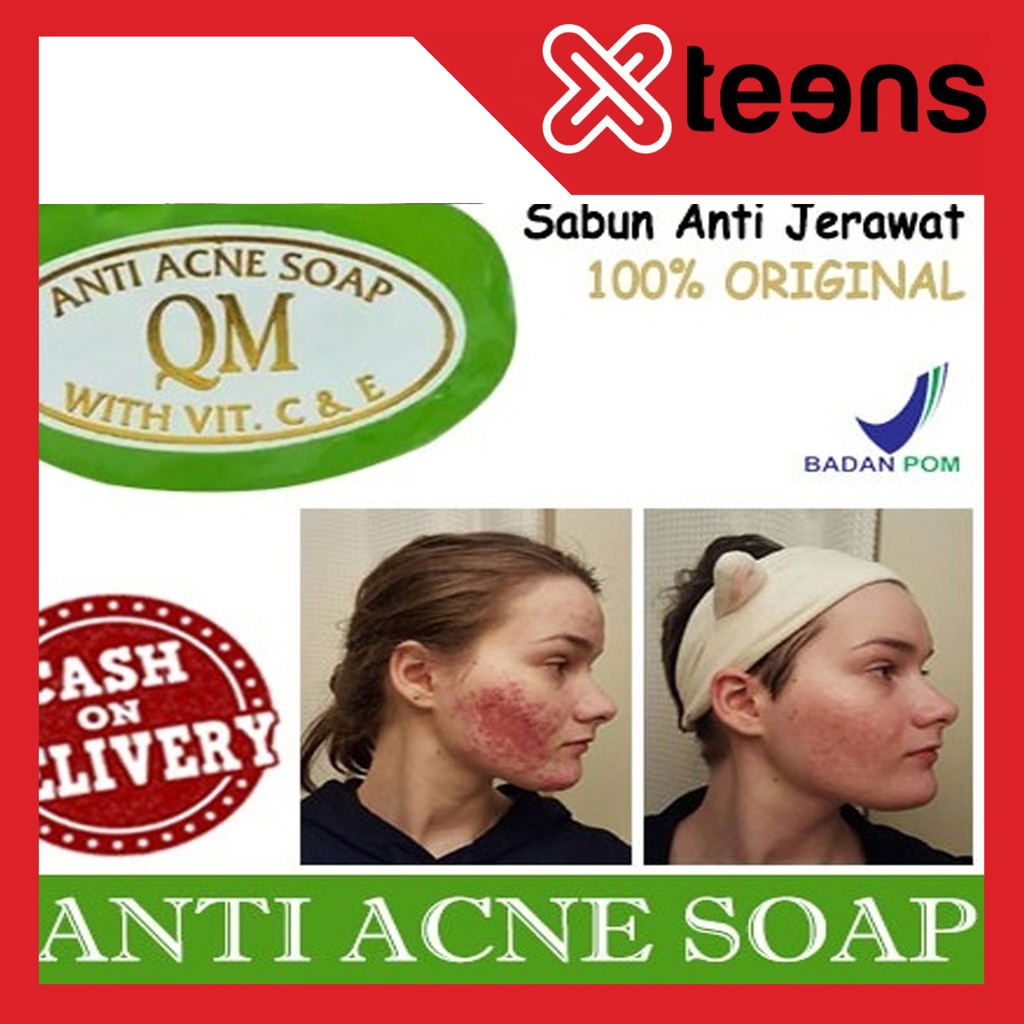 (BISA COD) ORIGINAL 100%  - SABUN QM HIJAU ANTI ACNE - SABUN ANTI JERAWAT - MENGHILANGKAN JERAWAT - KOMEDO