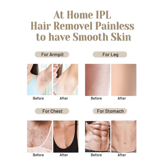 IPL LASER HAIR REMOVAL PERONTOK BULU PERMANEN ALAT IPL SMART TANPA SAKIT PENGHILANG BULU KEMALUAN PERMANEN TANPA SAKIT GARANSI MADE IN JAPAN