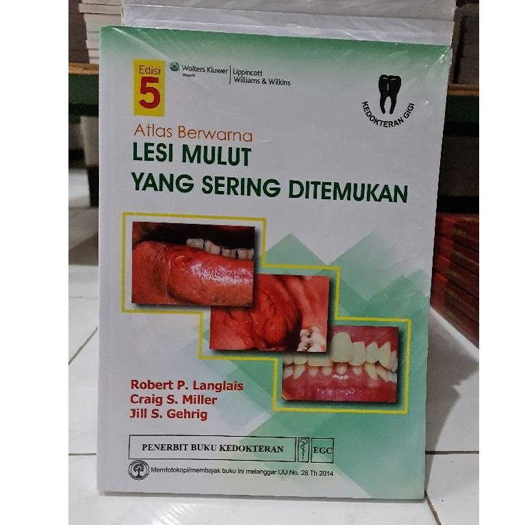 Atlas Berwarna Lesi Mulut yang Sering Ditemukan Edisi 5