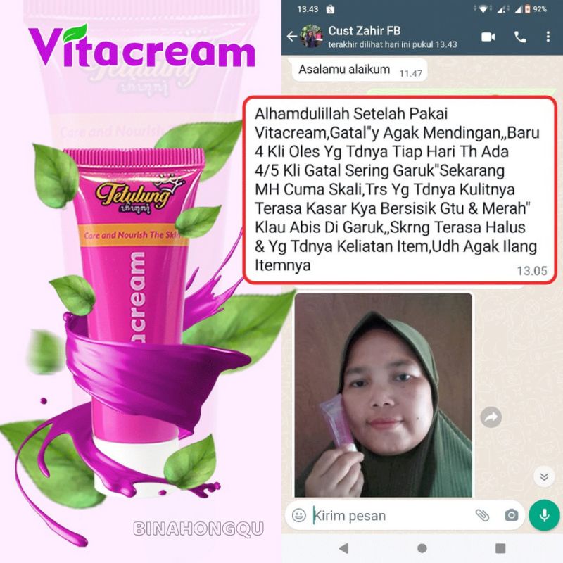 Salep Gatel Kulit Selangkangan Cewek Cowok Paling Ampuh Vitacream Binahong 20 Gr - Krim Vitacrem Selangkang Gatal Jamur Menahun Paling Ampuh - Cream Gatal Jamur Dewasa Ampuh - Obat Selangkangan Gatal Gatal Menahun Vita crem Binahong-2