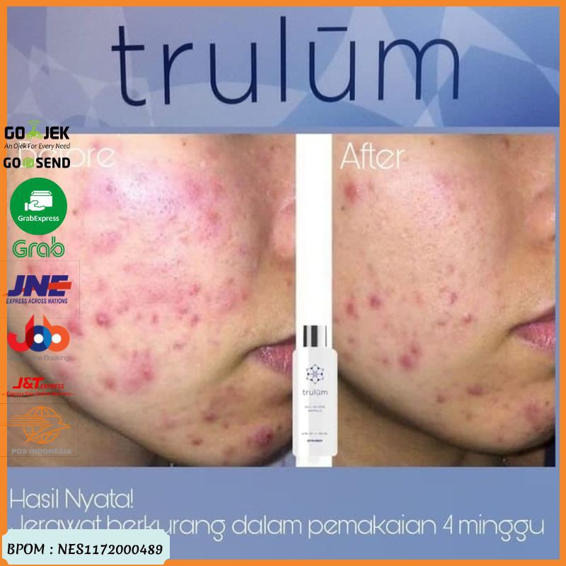 Penghilang Keriput Pada Wajah | Trulum Pengganti Krim Wajah