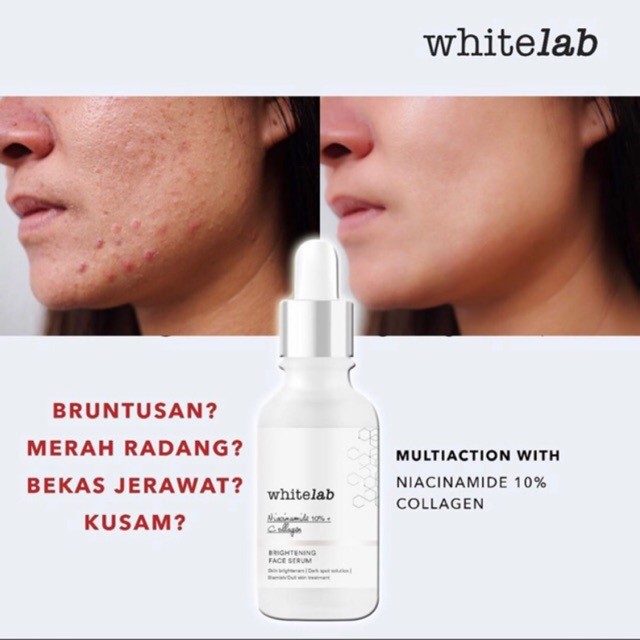 [BPOM] Whitelab Face Serum [Brightening | Bakuchiol | C-DOSE | A-DOSE | Probiome | Real Barrier | Age Correction |Acne Calming]