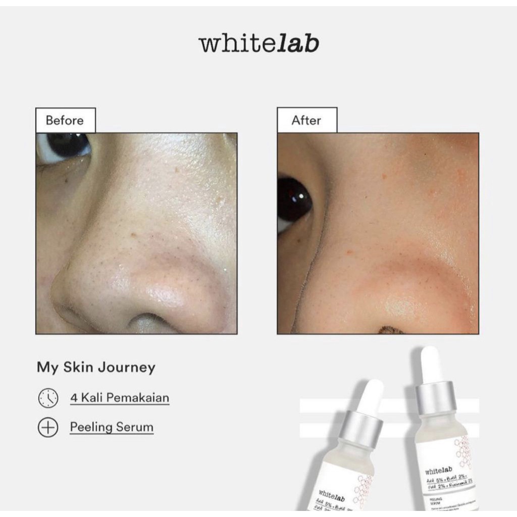 Whitelab Peeling Serum AHA BHA PHA 15ml