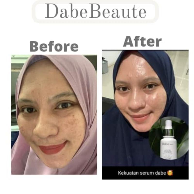 Dabe Beaute Skincare Original BPOM by Bella Shofie (free Gift)