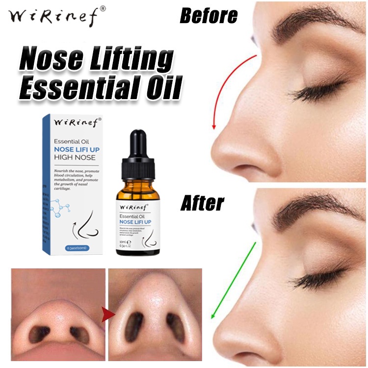 Minyak esensial pelembab Alat pemancung hidung Minyak esensial hidung 10ml Pijat hidung pemancung original nose oil lift up