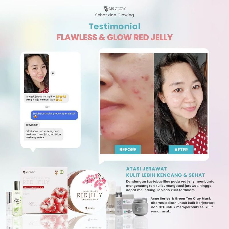 RED JELLY LACTOBACILLUS || MS GLOW