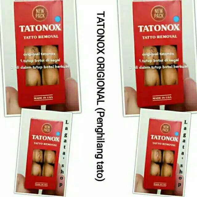 Tattonox penghilang tatto