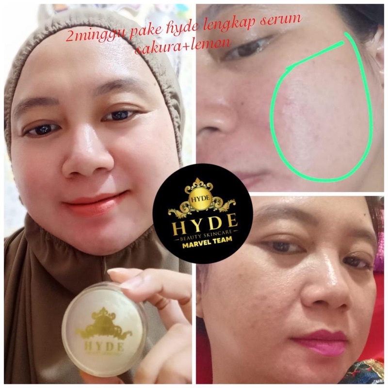 Hyde Beauty Skincare Paket Glowing