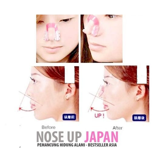 Nose Up Clipper - Pemancung Hidung Alami