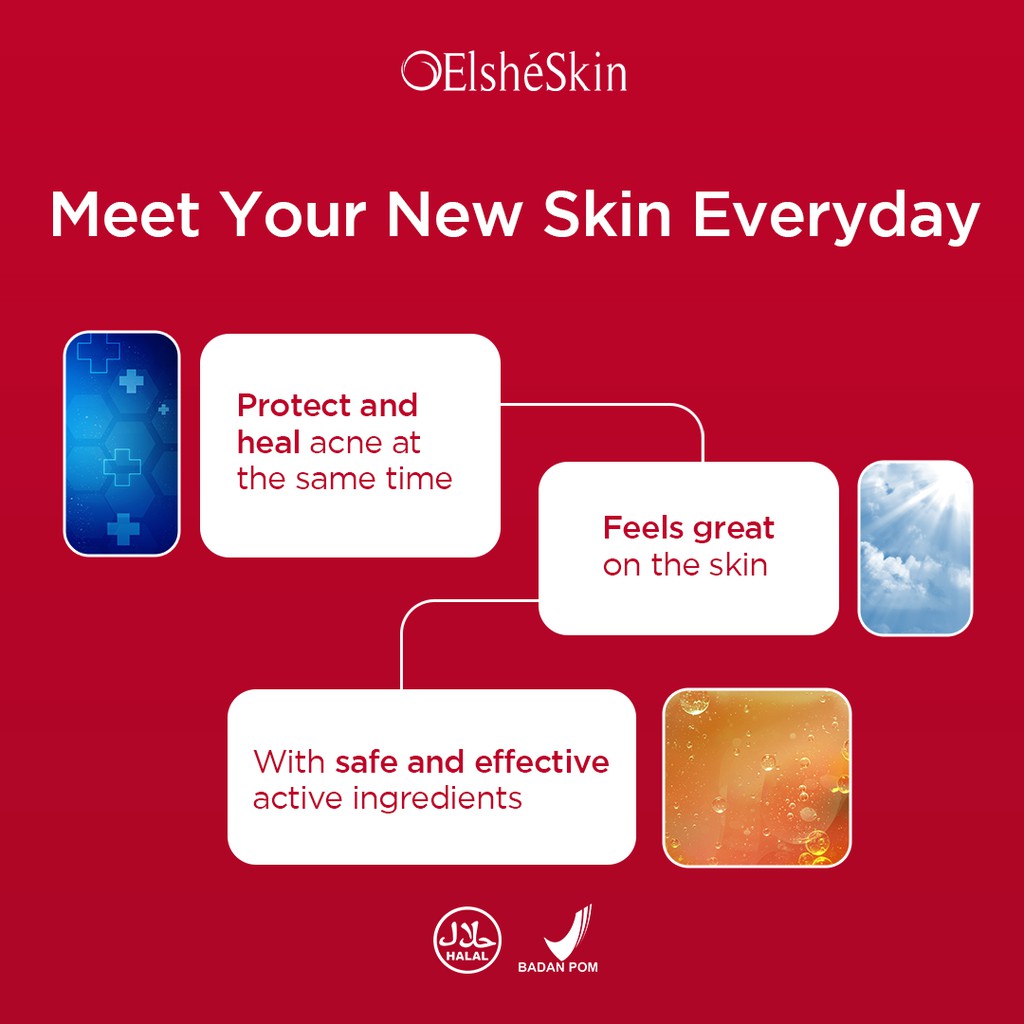 Elsheskin Daily Protection For Acne