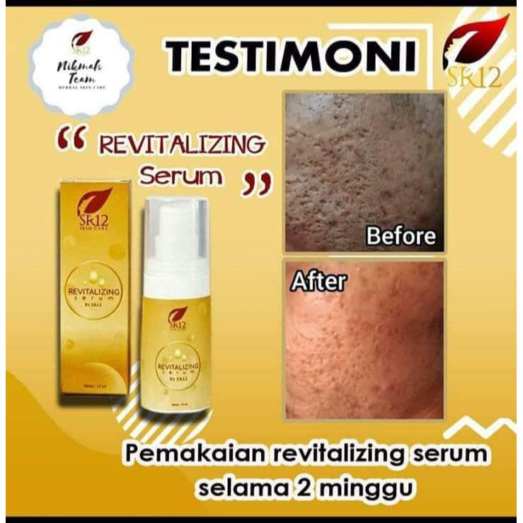 SERUM BOPENG AMPUHH MENGURANGI BOPENG WAJAH/MELEMBABKAN WAJAH/MENGECILKAN PORI-PORI