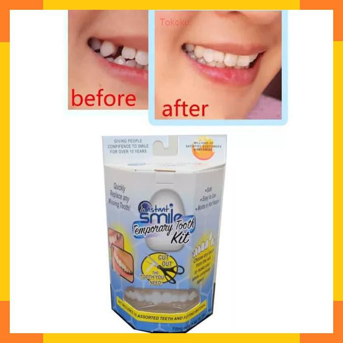 Gigi Palsu Ompong Gigi Tiruan Tempel Perfect Smile Veeners