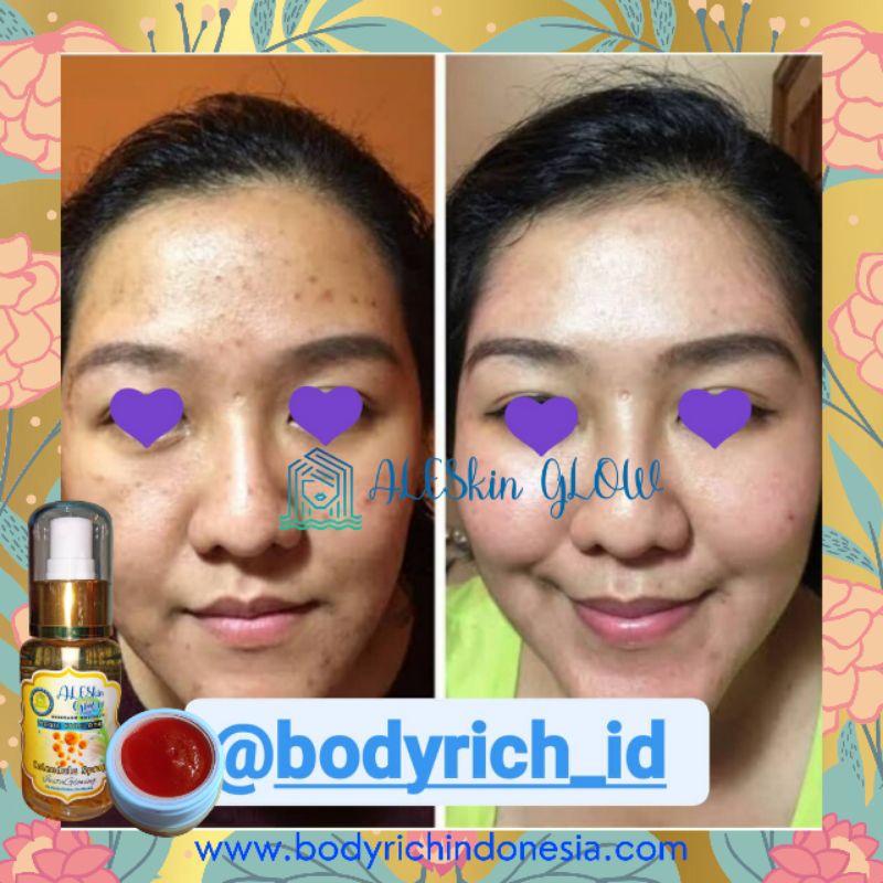 LUXURY ARBUTIN JELLY ALESKIN GLOW Skincare Glowing-Paket Perawatan Wajah Korea-Cream Glowing