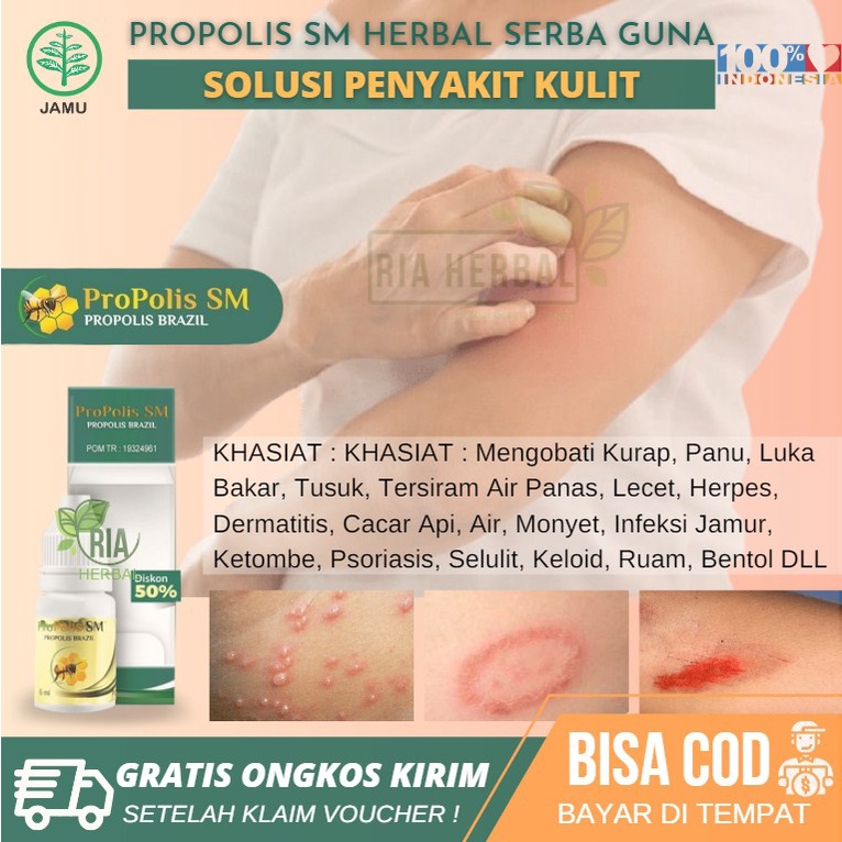 Obat Oles Luka Bekas Knalpot yang Alami 100% ASLI, Bekas Luka Bakar, Bekas Budug, Bekas Cacar, Salep