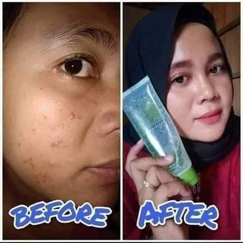 NaturaWorld Aloe Vera Soothing Gel