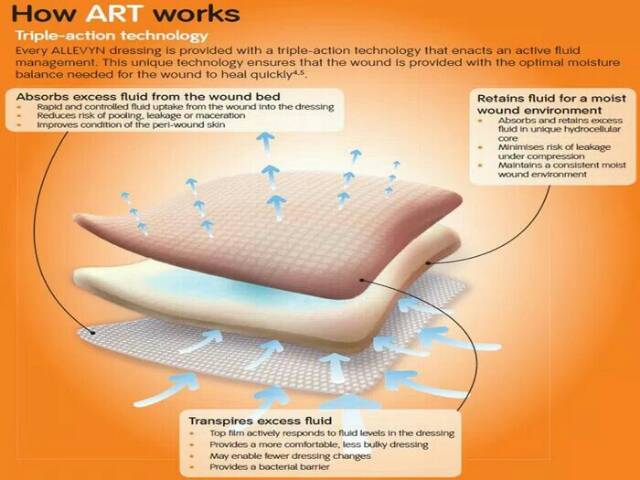 foam allevyn adhesive untuk luka beronggga dan eksudat banyak