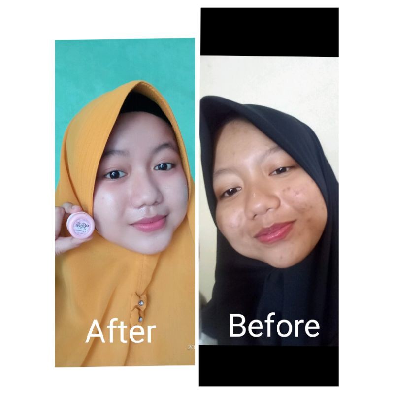 PROMO Paket Skincare Gbee Glow Beauty small kinclong Termurah (mempercepat glowing pada kulit wajah)-5