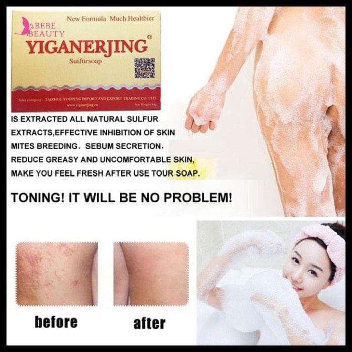 PROMO SABUN YIGANERJING / SABUN SULFUR UNTUK BERBAGAI MACAM PENYAKIT