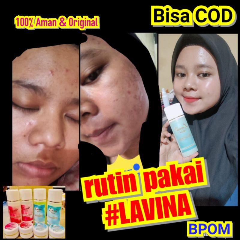 cream lavina skincare bpom