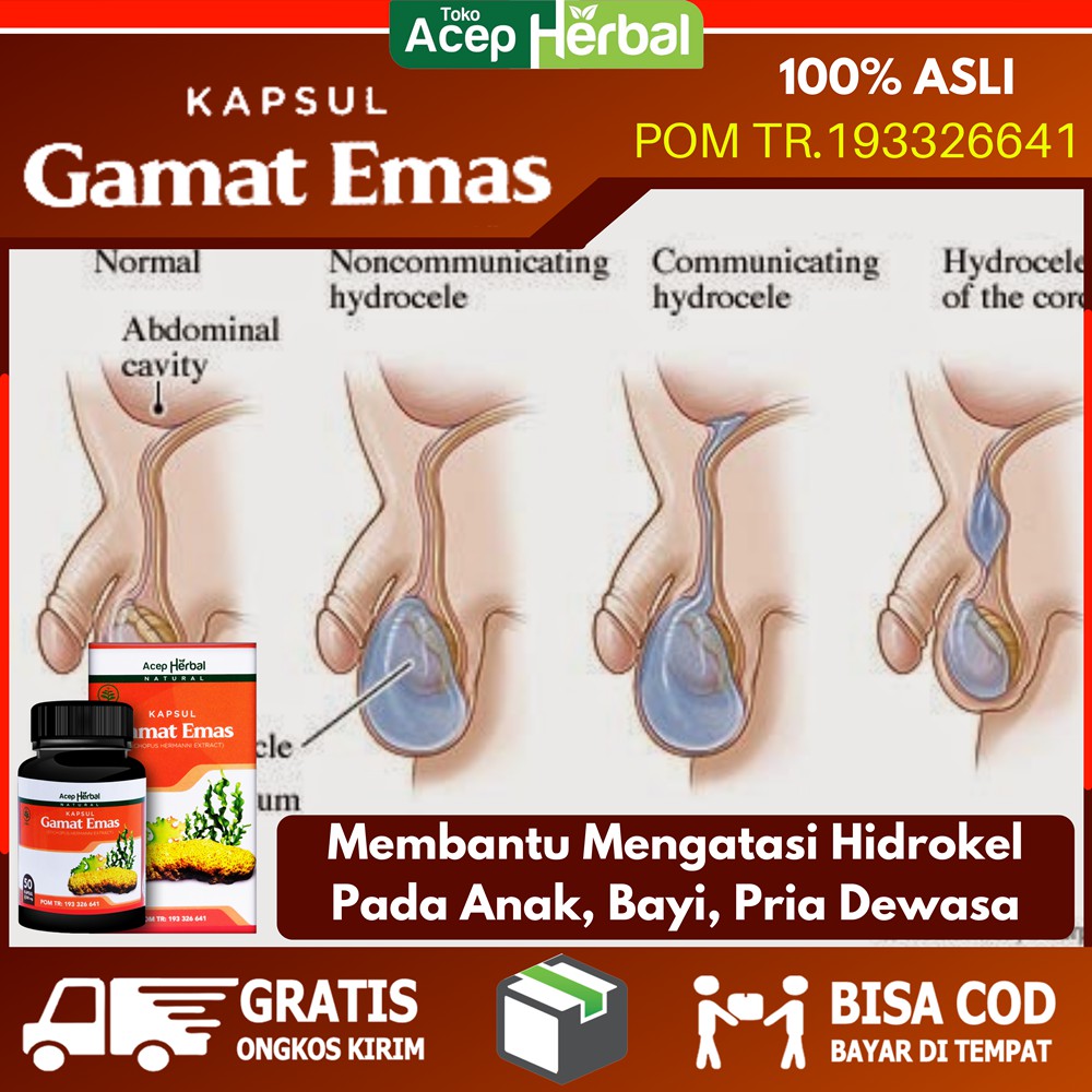 Obat Herbal Hidrokel Obat Hidrokel Cairan Testis Buah Zakar Bengkak Nyeri Kantung Buah Zakar Shopee Indonesia