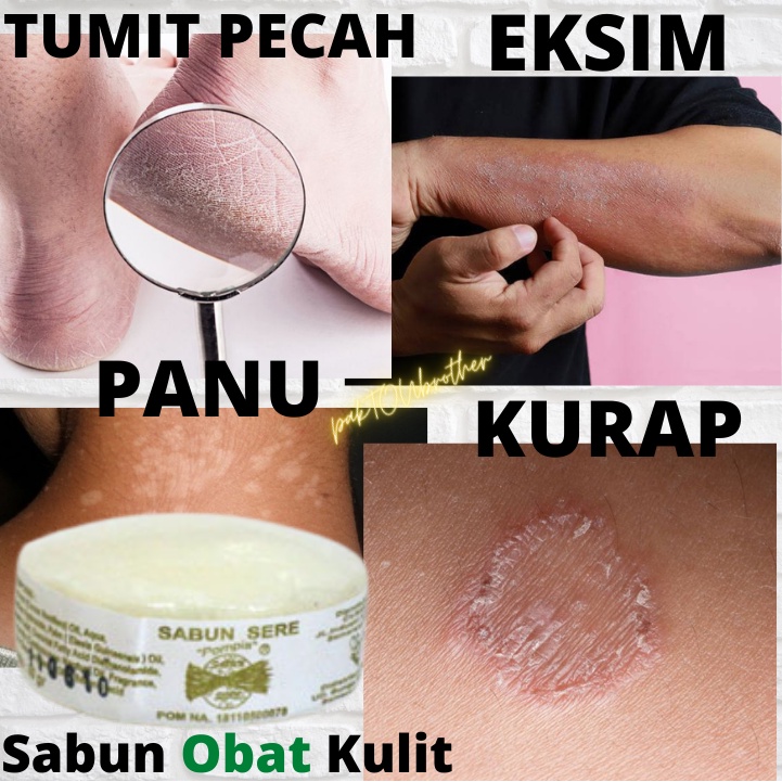 Jual Obat Kulit Gatal Gatal Eksim Obat Kurap Panu Jamur Kulit Infeksi