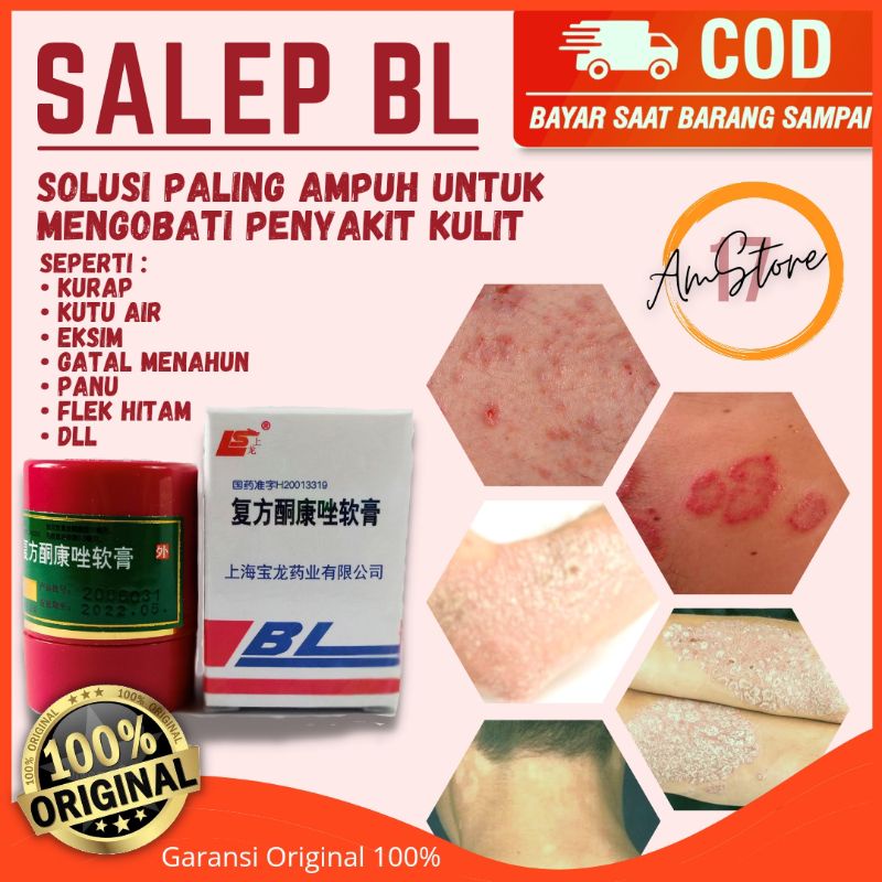 Jual Salep Gatal Paling Ampuh- Salep BL Panu Kurap Eksim Jamur Jerawat