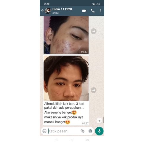 ADY78 Cream Aish Korean Beauty Day Cream & Night Cream Original 27g - Krim Aish Siang dan Malam