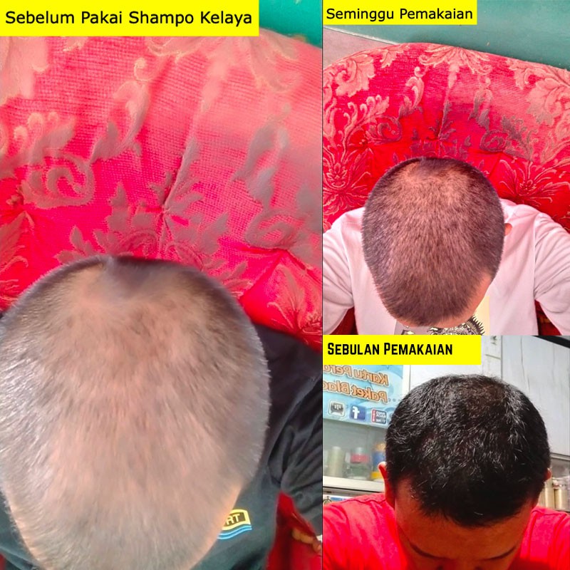 Kelaya Hair Treatment Shampoo Rambut Anti Rontok Sampo ORIGINAL BPOM