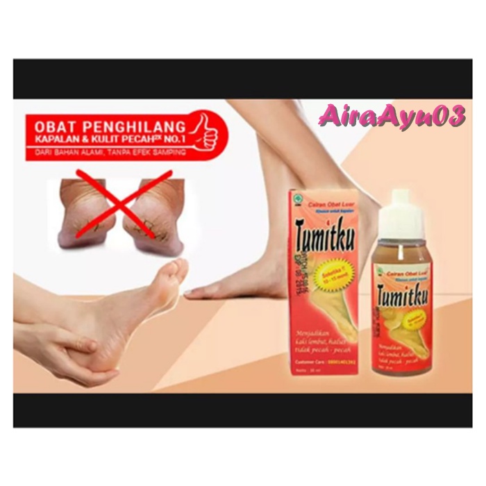 obat/ perawatan/ kuku/ kutu air/ kaki/ obat kaki pecah/  tumitku obat kaki pecah
