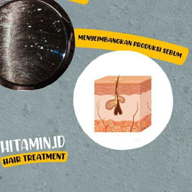 ☺ HITAMIN.ID SAMPO TREATMENT ATASI RAMBUT RONTOK KUSAM KETOMBE BERLEBIH KULIT KERING UBAN ORIGINAL ♣