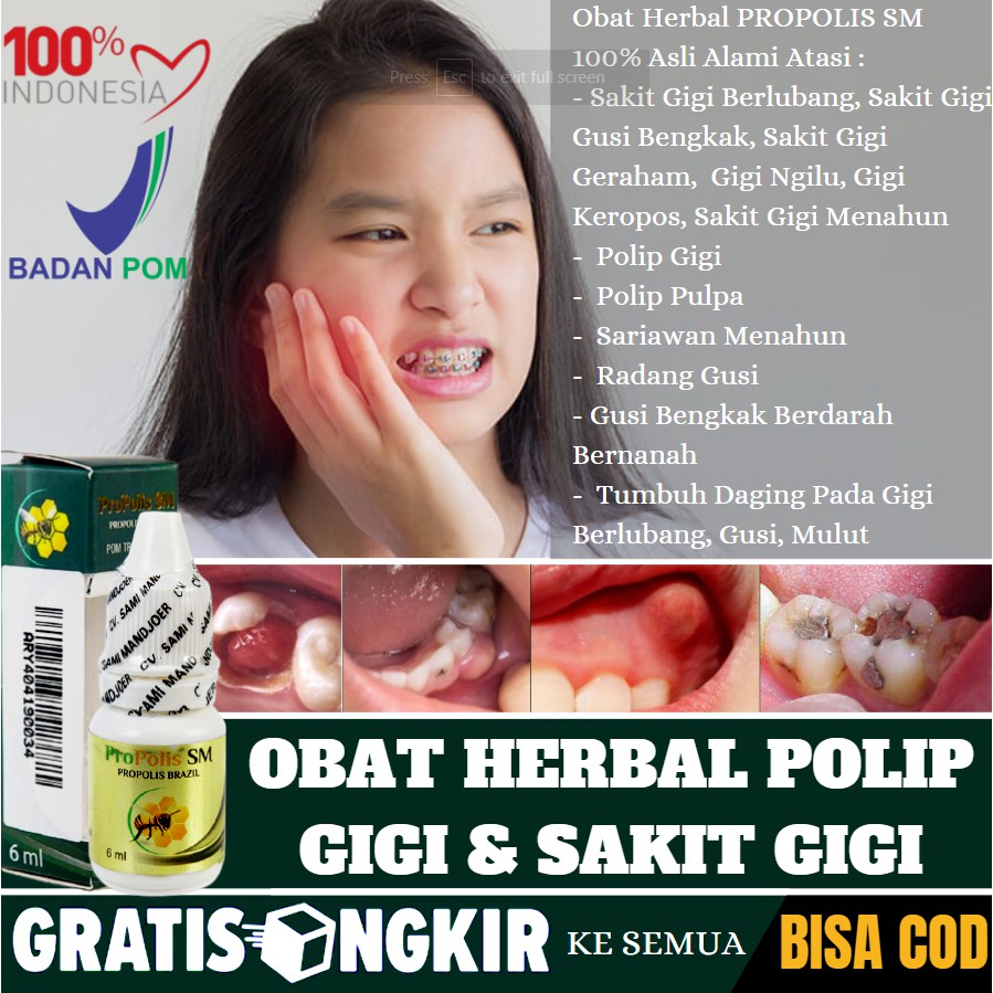 Obat Penghilang Tumbuh Daging di Gigi Berlubang, Polip Gigi Berdarah & Bengkak, Herbal Propolis SM