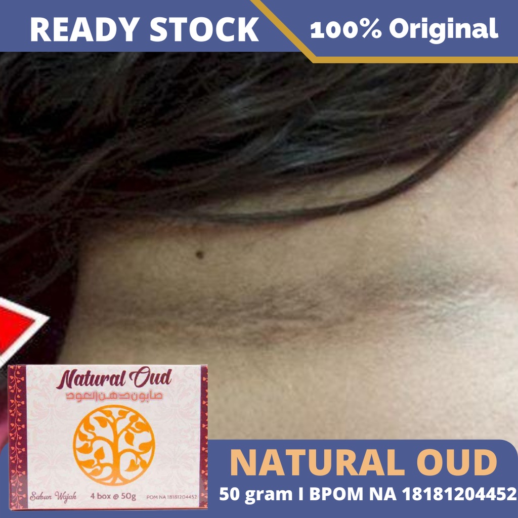 Sabun Penghilang Noda Hitam Di Leher, Obat Menghilangkan Garis Hitam Di Leher, Pemutih Kulit Leher, 