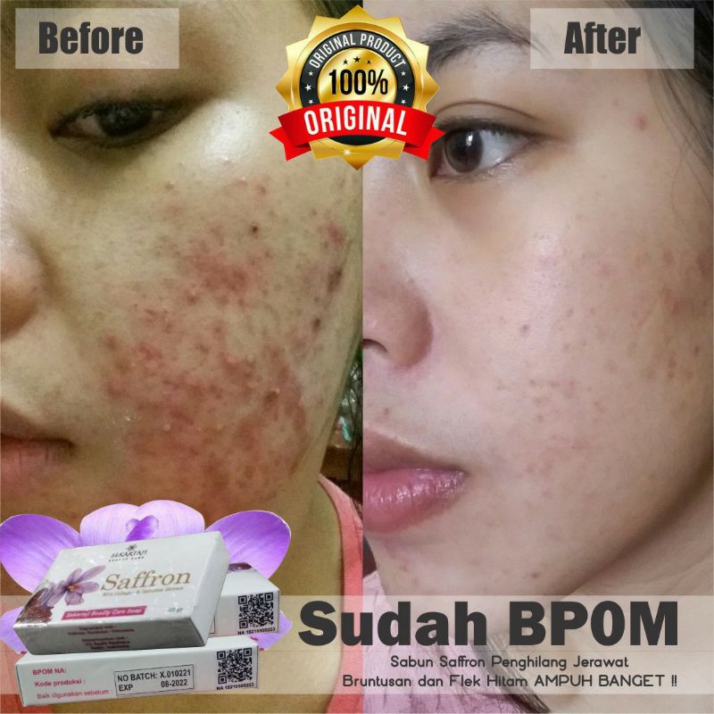 Sabun Safron with Spirulina Penghilang Jerawat Ampuh BPOM