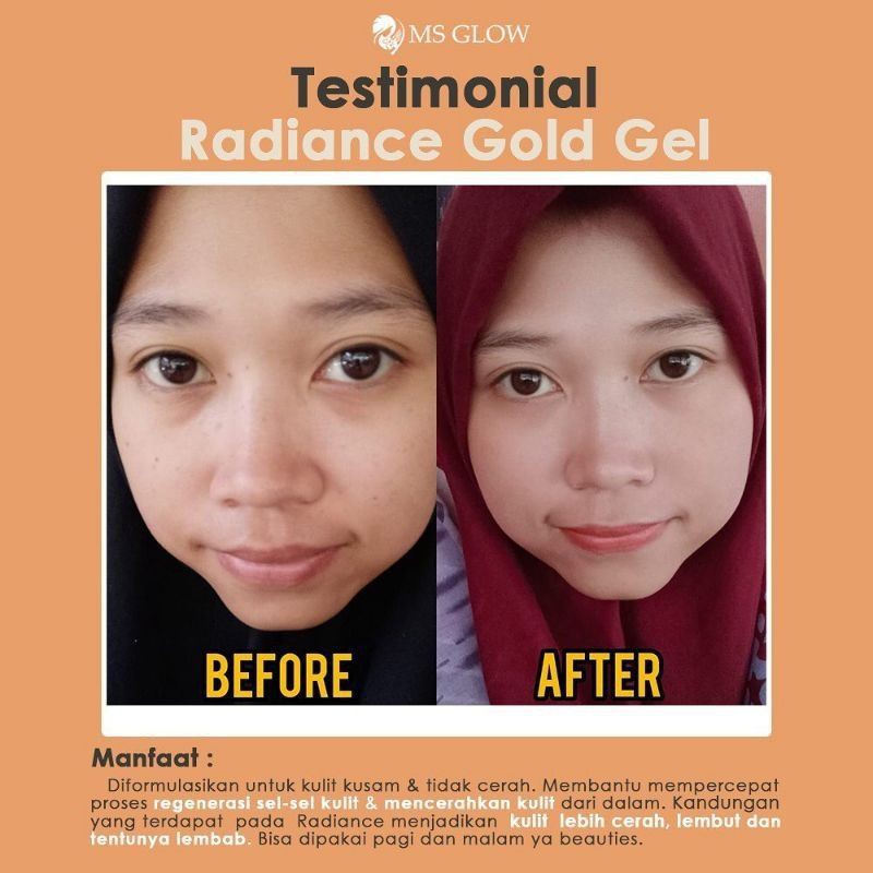 RADIANCE GOLD GEL MSGLOW