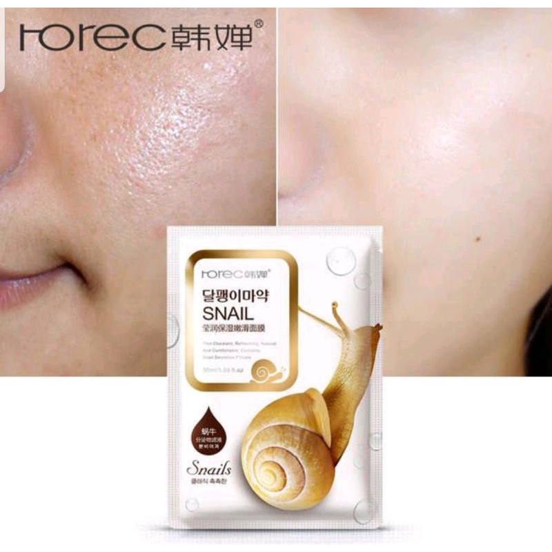 Rorec Snail Mask