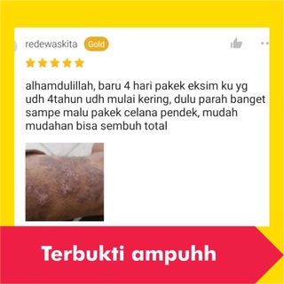 Salep Obat Gatal Paling Ampuh Kulit Gatel Eksim Kering Selangkangan Kurap Kudis Basah Jamur Kutu Air-1